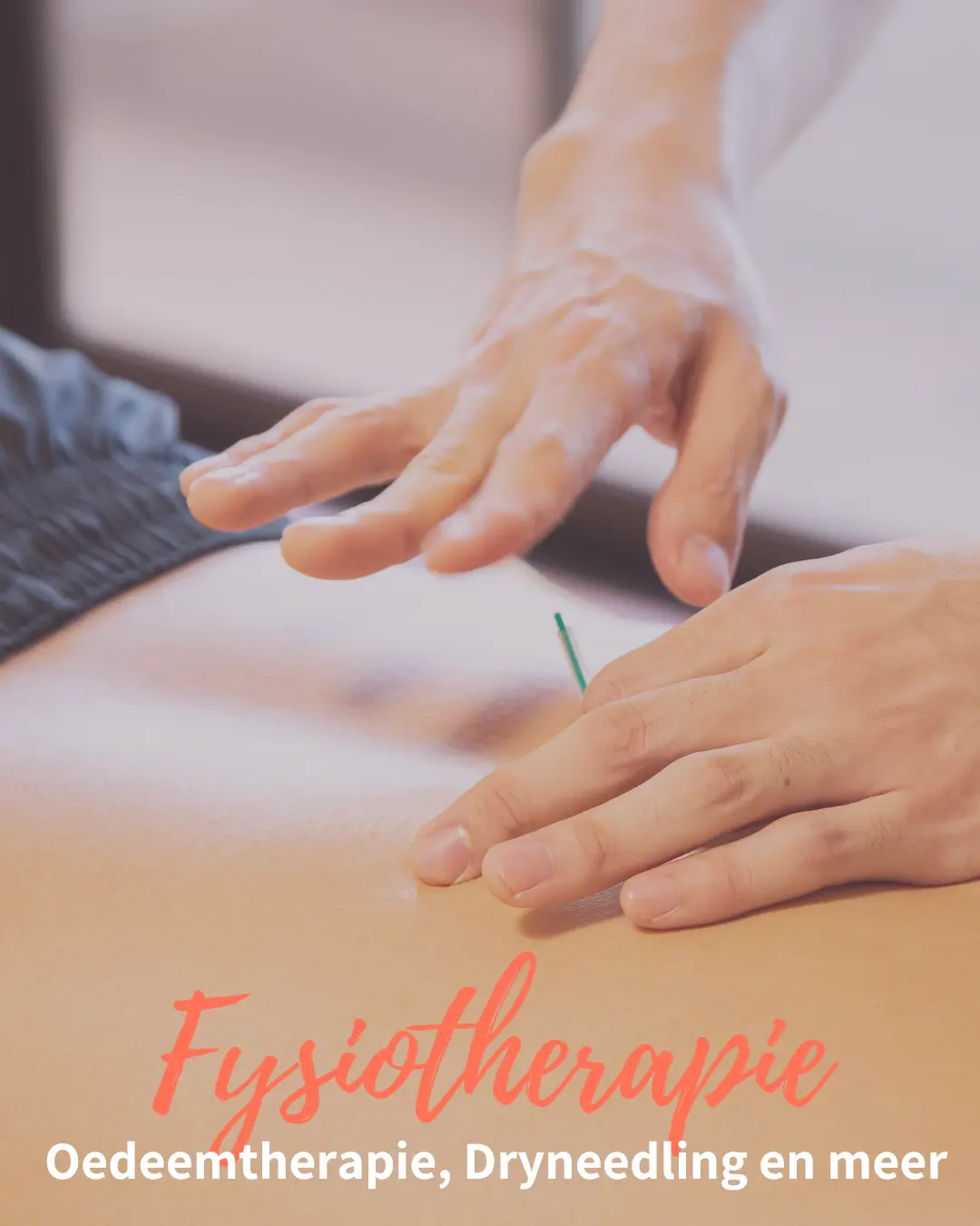 Fysiotherapie